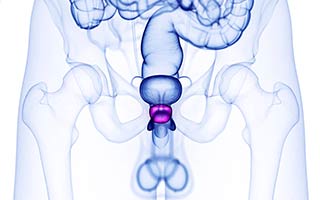Prostate Mapping